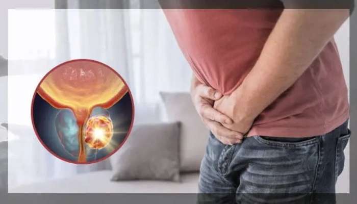 Xərçəng kişilərdə  sonsuzluğa səbəb olur?