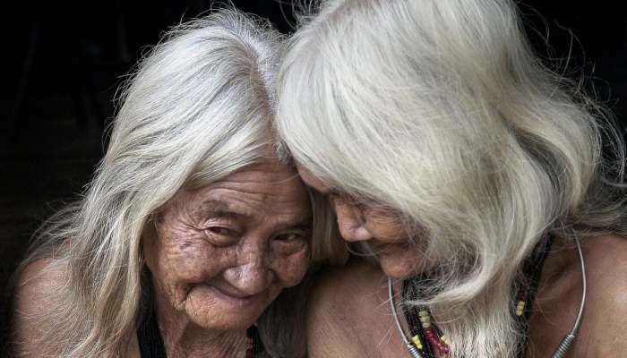 Demensiyanın ən incə əlamətləri  – 18 il əvvəl belə görünür