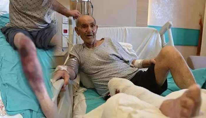 Təmizləyicisi vasitə ayağını yandırdı -  Xəstəxanalıq oldu-FOTO