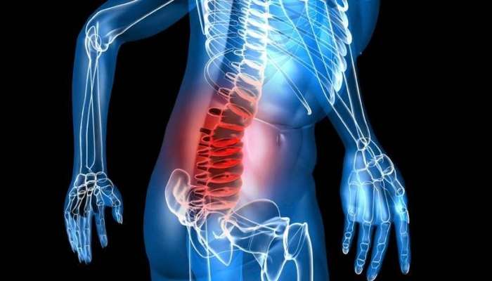 Çox yuxululuq və ağrılar mielomanın əlaməti  ola bilər