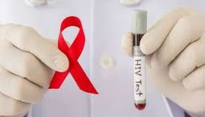 Azərbaycanda neçə HİİV xəstəsi var? 