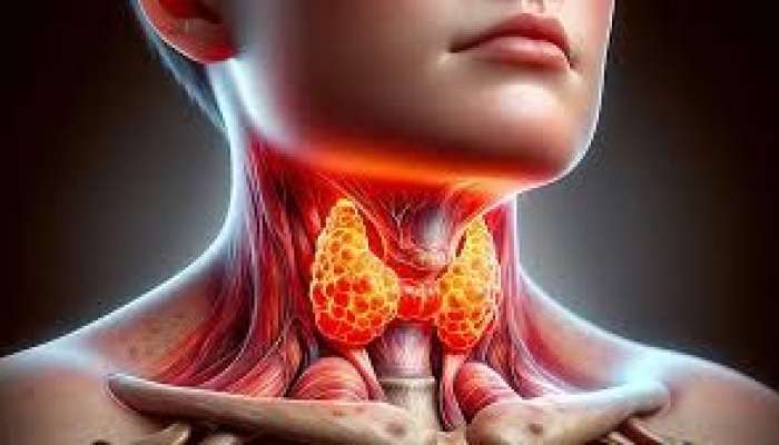 Sakit başlayan təhlükəli vəziyyət   - Yod defisiti