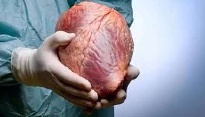 Donor ürəyi köçürülən insan    nə qədər yaşayır?