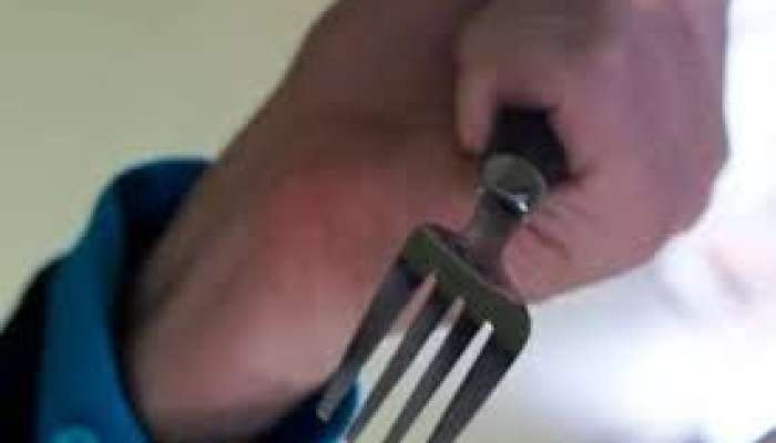 Yanağına çəngəl batan  oğlan    xilas edildi