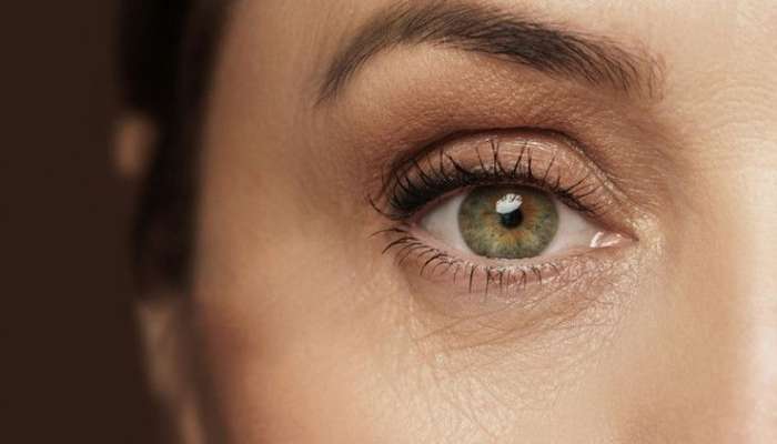 Gözləriniz yaşınızı göstərir -  Sallanmış göz qapaqları, qırışlar...