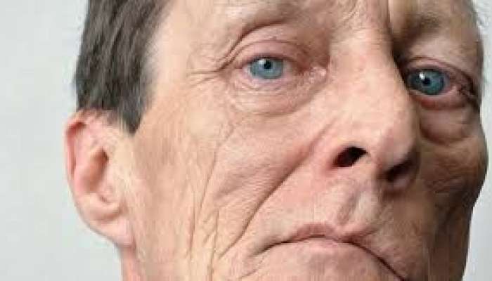 Mikro-insultun 5 təcili əlaməti - Hər kəs yoxlansın