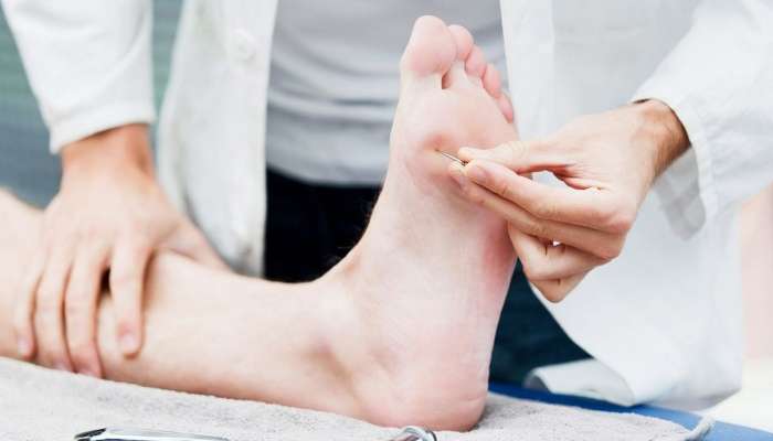 Diabet ayaqları necə zədələdi? –  90% yaxşılaşma ilə nəticələnən pasiyent hekayəsi