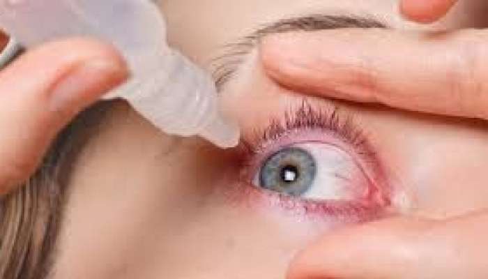 Gözlərin quru və yorğun olmasının    7 əlaməti