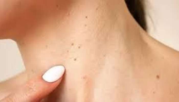 Bu simptomu ciddiyə almayanlar    peşman olur