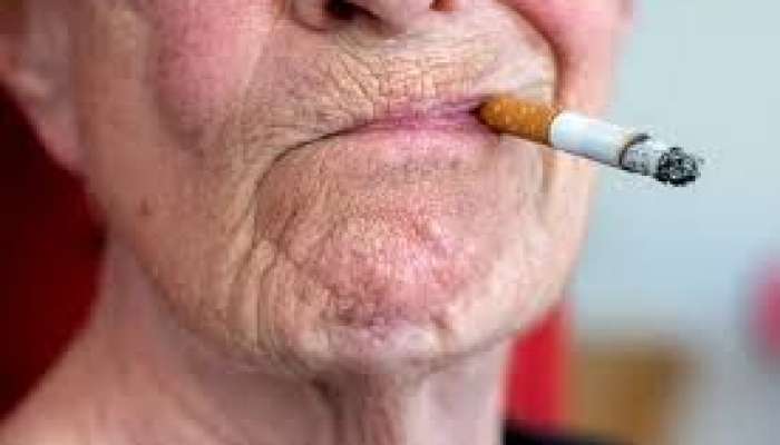 Nənənin siqaret çəkməsi nəvədə autzim yarada bilər  – ŞOK