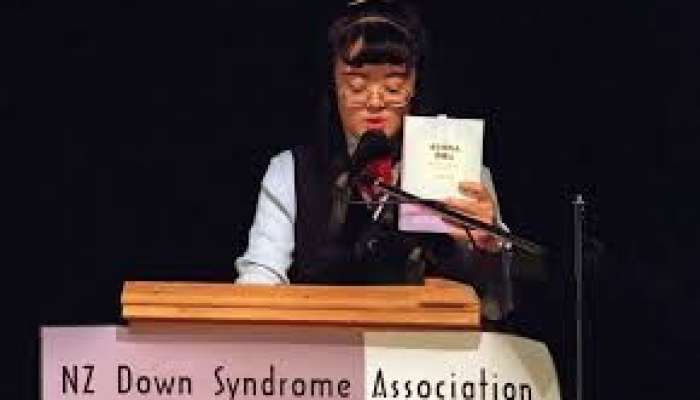 Dünyada ilk ali təhsil alan  Daun sindromu insan