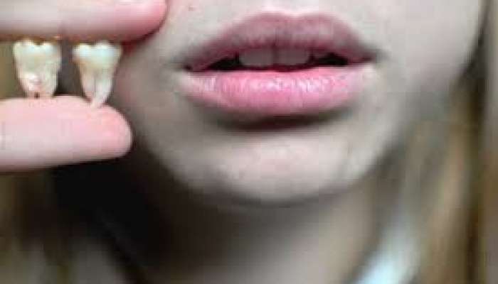 Ağıl dişi ilə insanın “ağlı” arasında əlaqə varmı? 