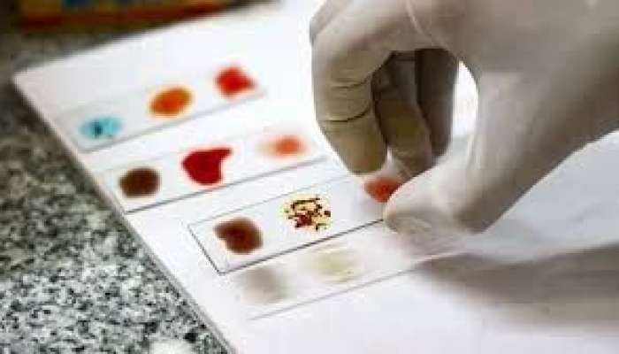 Dünyanın qızıl qan qrupu  - Azərbaycanda varmı?