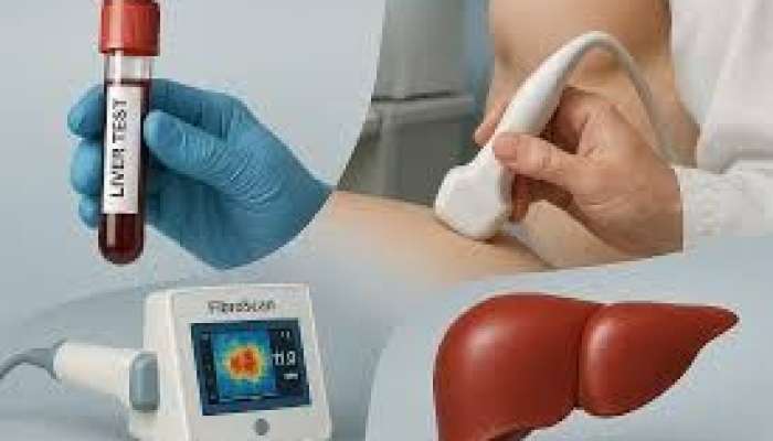 Qaraciyər sirrozu: hansı analiz və müayinələr vacibdir? 