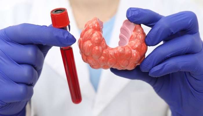 25 yaşlı qadına radioaktiv yod tövsiyə edildi -  İnteqrativ müalicə ilə əməliyyatsız nəticə əldə olundu