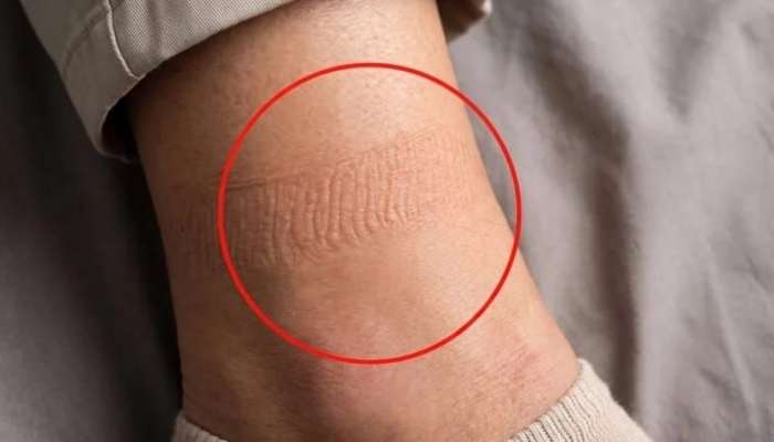  Corab izlərinə diqqət:  Əsl səbəbi budur