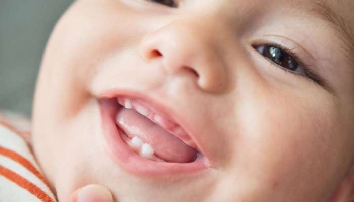 Körpələrdə dişçıxarma dövrü:  Valideynləri narahat edən əsas səbəblər və təhlükəsiz həll yolları