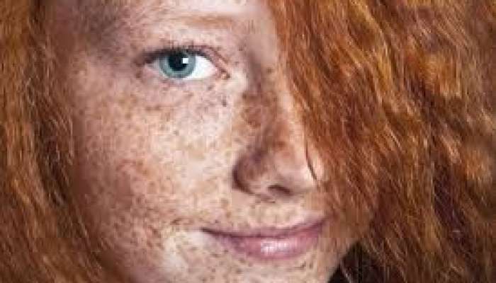 Dünyada kürənlərin sayı artır  – Səbəb