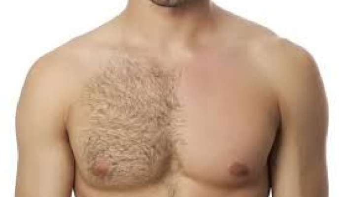 Bədəni və üzü az tüklü olan kişilərdə nə çatışmır? 