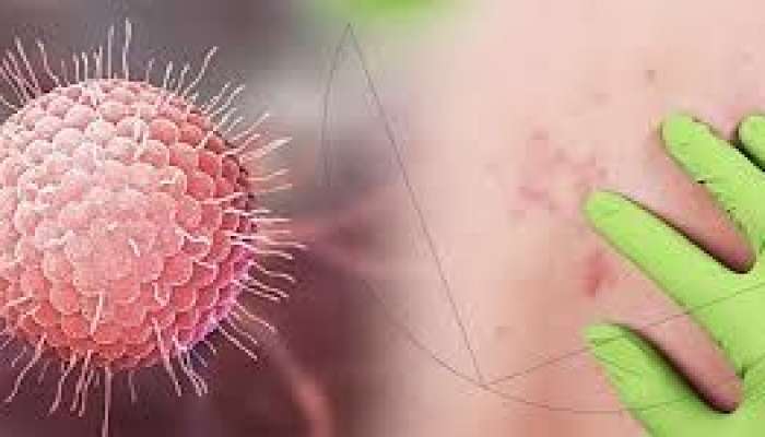 Bu virus bədəndə on illərlə yaşaya    bilər