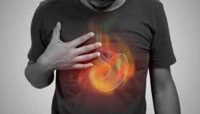 Mədə yanmasının vaxtı tromblaşmadan    xəbər verir