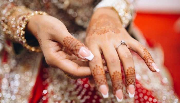 Xınanı əldən necə silmək olar? -  Üsullar