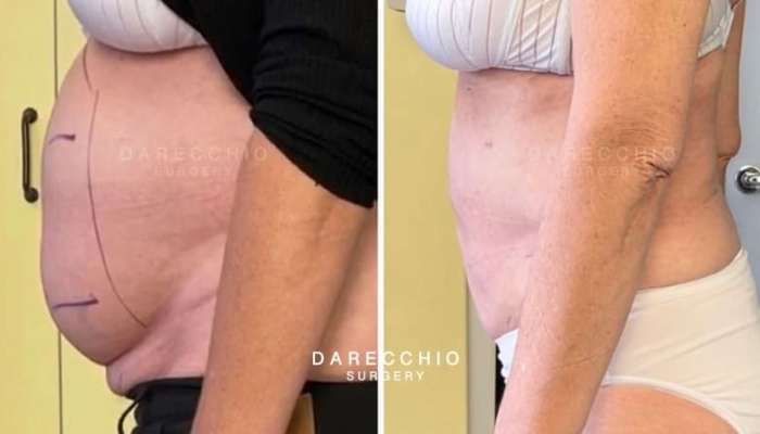  Qadının qarnı önə doğru çıxırsa... -   Səbəbləri - VİDEO