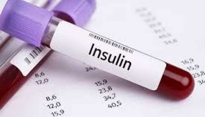 İnsulin 14-dən yuxarıdır    - Bu nə deməkdir?
