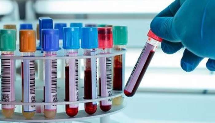 İşə qəbulda narkoloji rəy  təqdim ediləcək