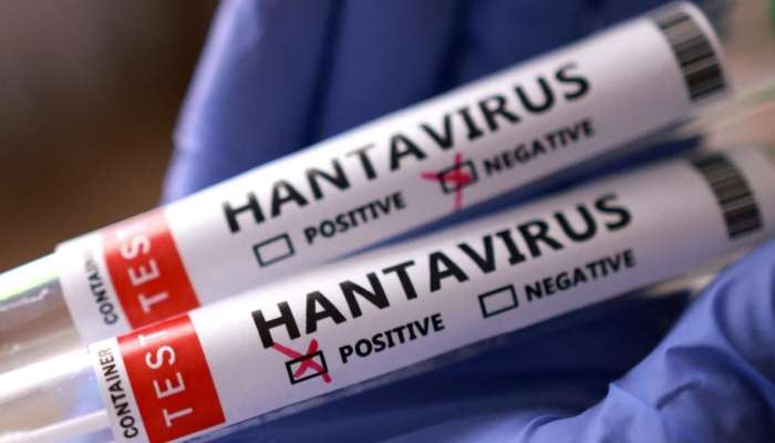 Hantavirus COVID-19-dan  təhlükəlidir?