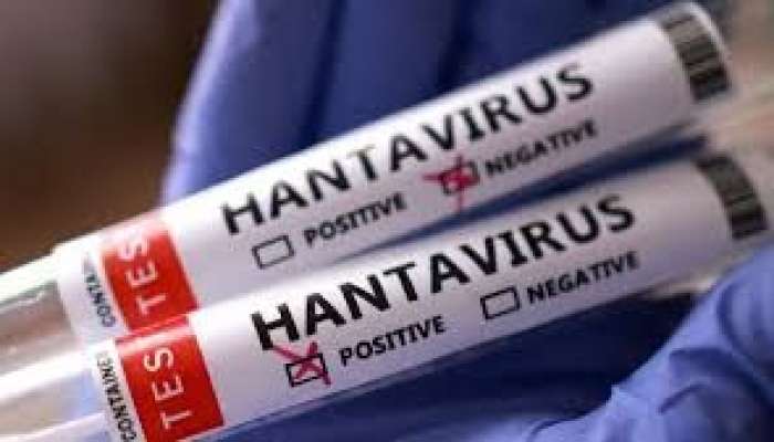 Hantavirus Türkiyədə   - Şübhəlilər karantində