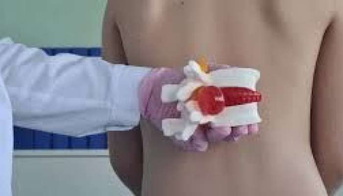 Bel yırtığı (disk yırtığı) olanlara   - cinsi əlaqə olarmı? 