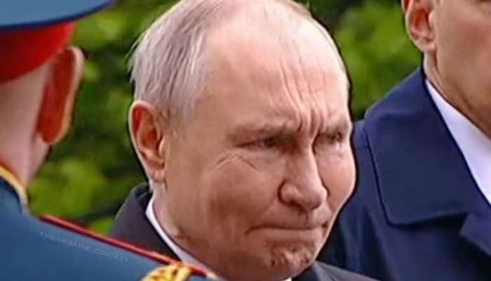 Putinin üzündəki şişkinlik:  Xəstəlik, yoxsa botoks?