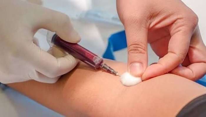 Azərbaycanda şəkər xəstələri insulin almaqdan ötəri  hər ay analiz verməlidir?