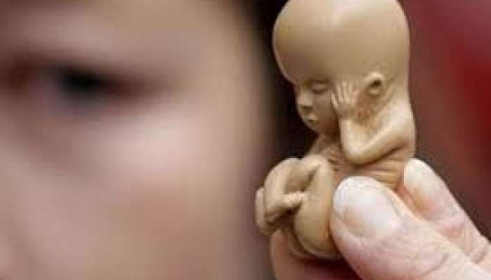 Azərbaycanda abortların sayı artıb 