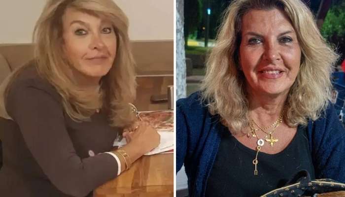 İtkin qadının kimliyi  implant və platinlə müəyyənləşdirildi