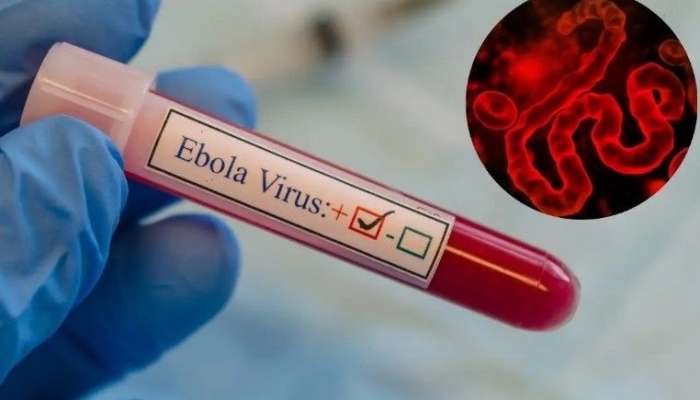 Ebola virusundan 139 nəfər ölüb - RƏSMİ