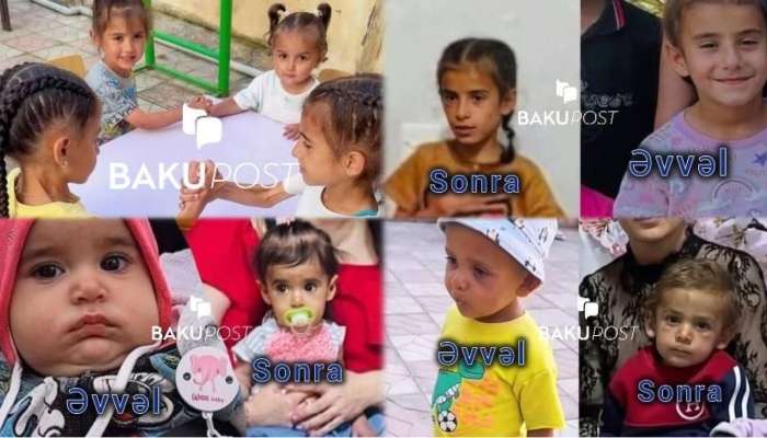 Sığınacaqda uşaqların  görüntüsü dəhşətə gətirdi - Aclıqdan anoreksiya olublar? - Fotolar