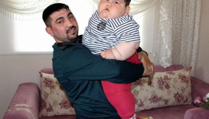 5 yaşında 90 kilo idi -  İndi onu görənlər tanıya bilmirlər-FOTO