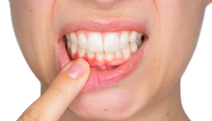 Diş problemləri təkcə ağız boşluğu ilə  məhdudlaşmır