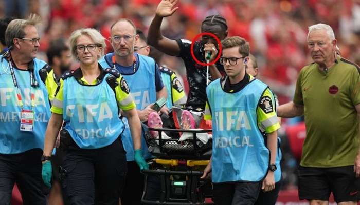 Ayağı sınan futbolçunun ağzındakı yaşıl cismin  nə olduğu ortaya çıxdı - FOTO