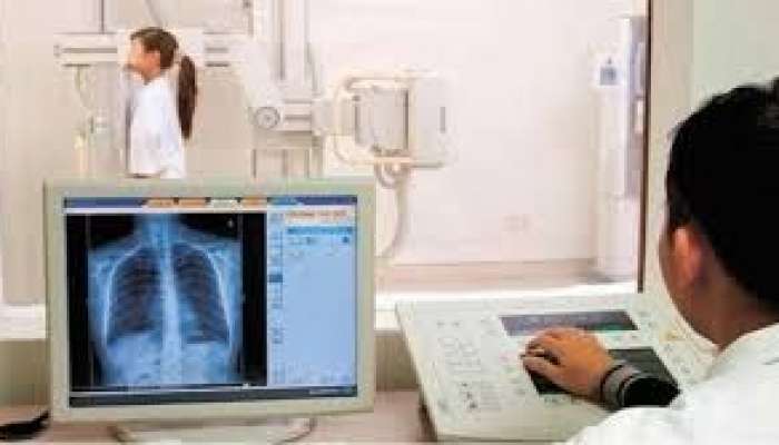 Poliklinikalarda rentgen kabinetləri niyə azalır?  – Şikayət
