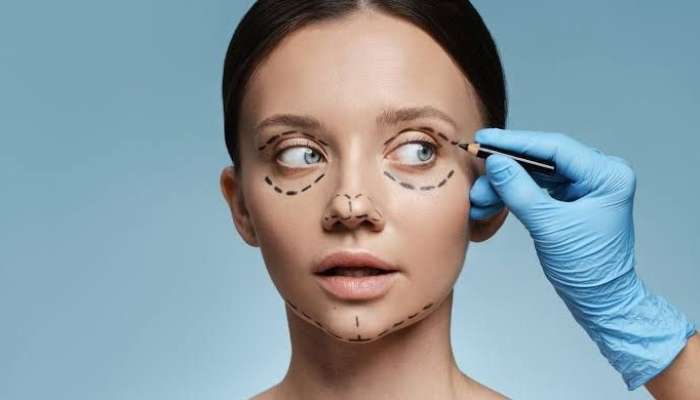 Gözaltı blefaroplastikanın  risklərini çoxu bilmir  – Həkim