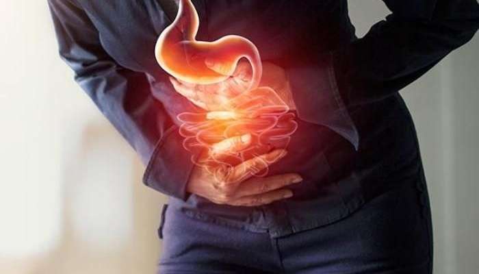 Mədə yanması –  Həmişə qastrit deməkdirmi?