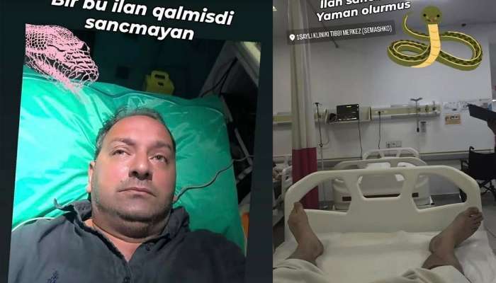 Elnur Kərimovu ilan sancdı -  FOTO