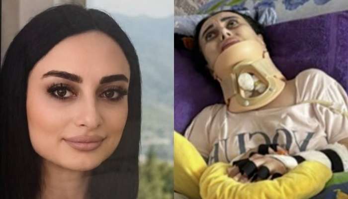 Əməliyyatdan sonra iflic olan Nigar vəfat etdi 