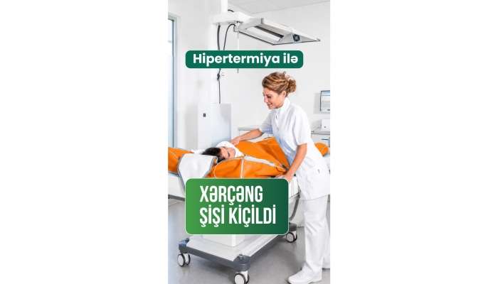 Onkoloji xəstələr üçün yeni ümid:  Hipertermiya müalicəsi