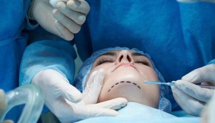 Azərbaycanda plastik cərrahların sayı artdı 