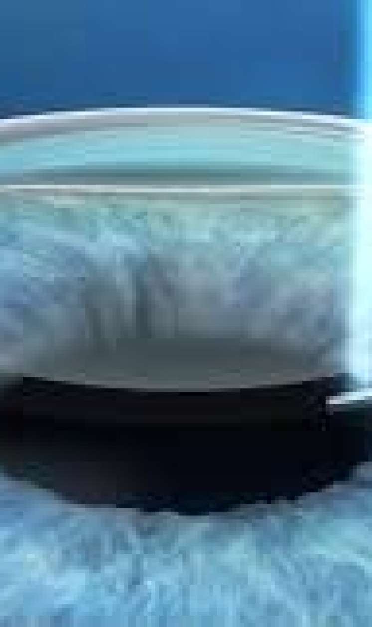 Bu nevroloji xəstəliyin ilk əlaməti    gözlərdən başlayır