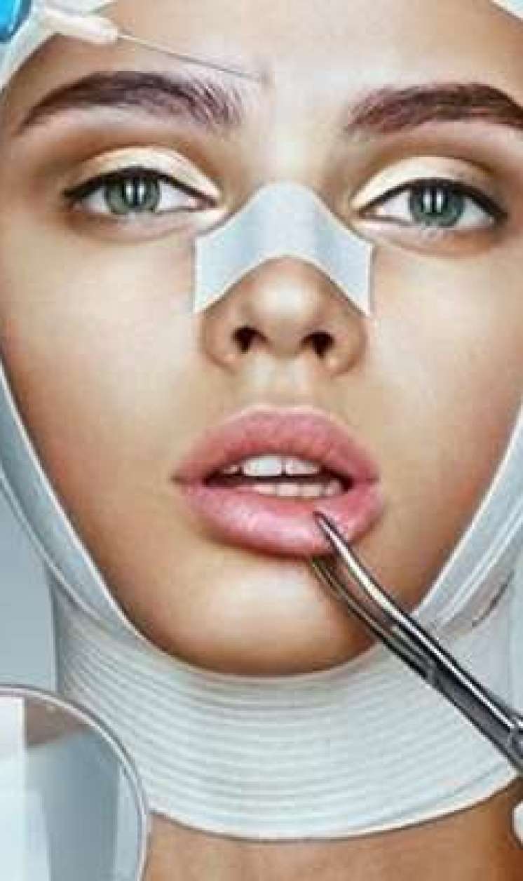 Bu şəxslərə burun əməliyyatı  pulsuz oldu